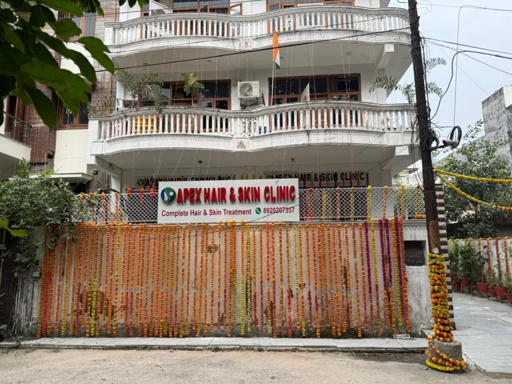 APEX HAIR TRANSPLAT IN NOIDA