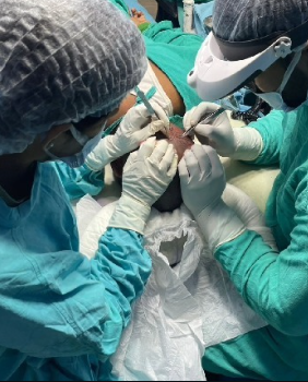 hair transplant clinic before after results